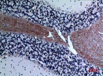 Eotaxin-3 antibody