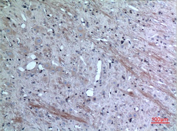 Eotaxin-3 rabbit pAb Antibody