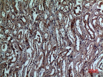 BNIP-3 rabbit pAb Antibody