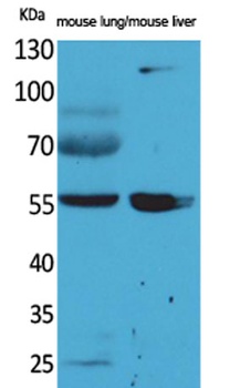 ALDH1A1 antibody