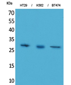 BRMS-1 antibody