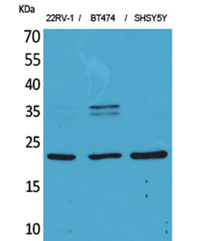 FGF-12 antibody