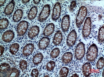 CD66e rabbit pAb Antibody