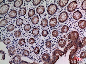 CD66e rabbit pAb Antibody