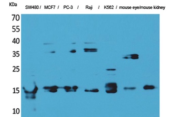 MK antibody