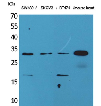 FGF-18 antibody