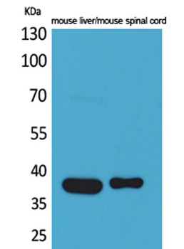 Aldolase C antibody