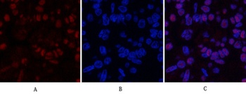 MDM2 antibody