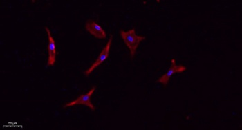 CD133 antibody