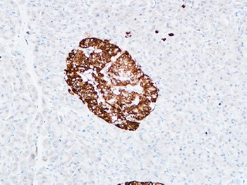 CD133 rabbit pAb Antibody