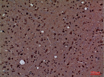 CyPA rabbit pAb Antibody