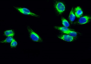 Cdk4 rabbit pAb