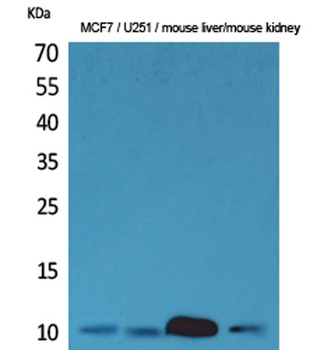 ACBP rabbit pAb