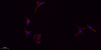 IL-1β rabbit pAb