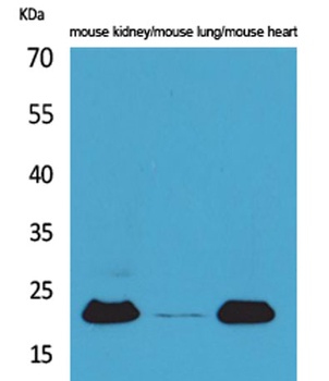 Adrenomedullin antibody