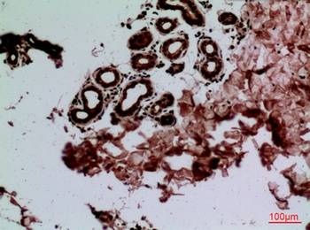 CEACAM1/5 rabbit pAb Antibody