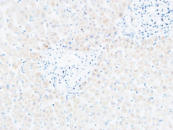 BLC rabbit pAb Antibody