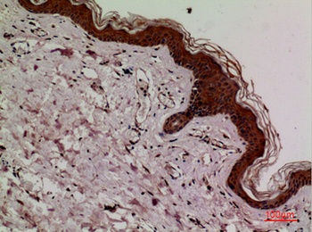 Keap1 antibody