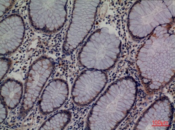 Lipocalin-1 rabbit pAb Antibody