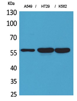 ERp57 antibody