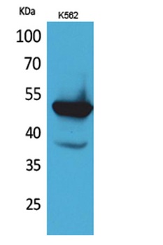 Protein C antibody