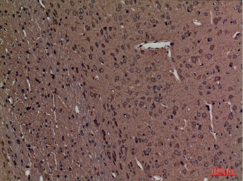 SPTLC1 rabbit pAb Antibody