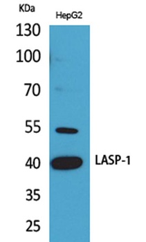 LASP-1 antibody