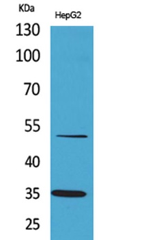TFPI rabbit pAb Antibody