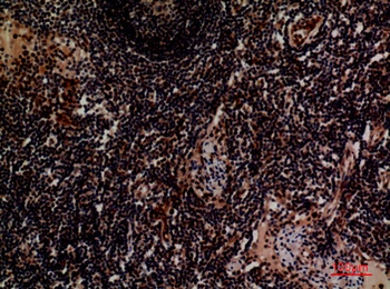 Integrin α4 rabbit pAb Antibody