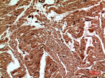 CD59 rabbit pAb Antibody