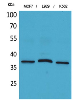 CD79b antibody