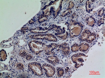 CD203c antibody