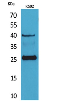CD161 rabbit pAb Antibody