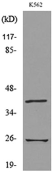 CD161 rabbit pAb Antibody