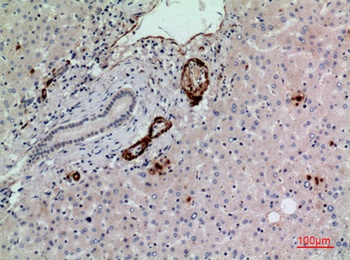 CD241 rabbit pAb Antibody