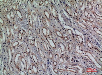 CD159a/c antibody