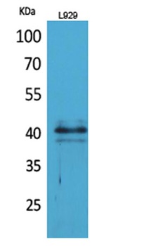 CKR-4 antibody