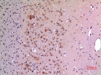 GDF-5 rabbit pAb Antibody