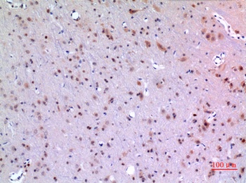 ARP rabbit pAb Antibody