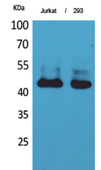 SCCA1/2 antibody