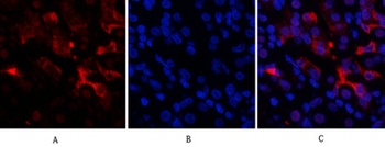 Bcl-6 antibody