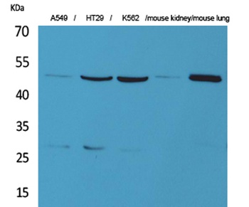 GDI-2 antibody