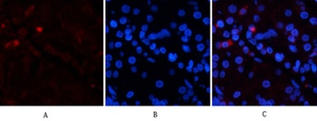 EPAS-1 antibody