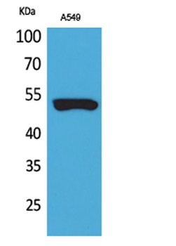 Cytokeratin 8 rabbit pAb