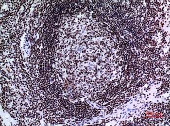 p73 rabbit pAb Antibody