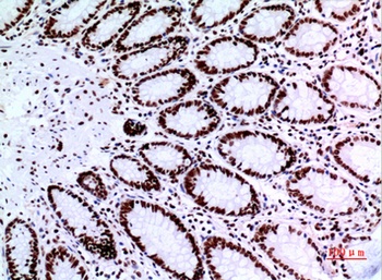 p73 rabbit pAb Antibody