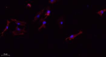 IL6 antibody