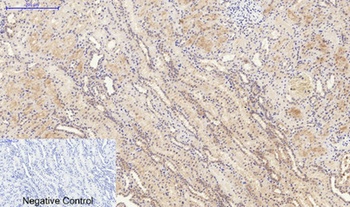 IL-6 rabbit pAb Antibody