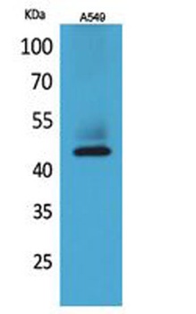 Cytokeratin 19 rabbit pAb