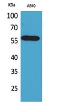 ALDH2 antibody